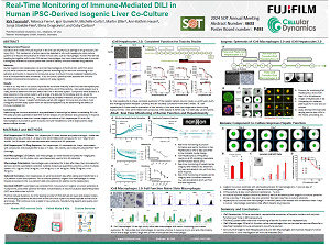 Real-Time Monitoring of Immune-Mediated DILI in Human iPSC-Derived Isogenic Liver Co-Culture