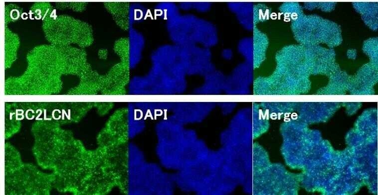 未分化性維持の確認