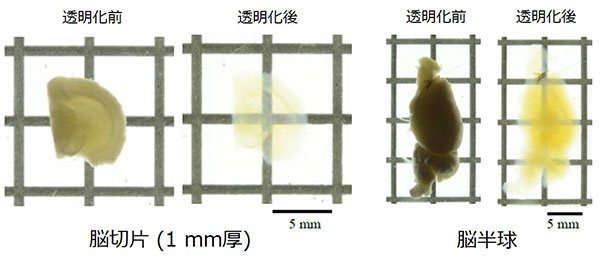 マウス脳切片および脳半球の透明化