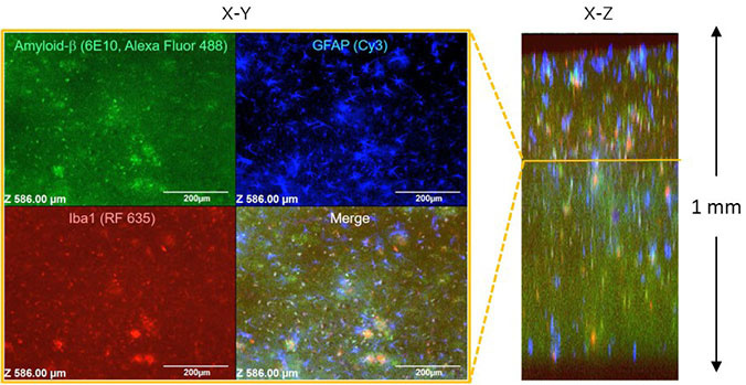 アルツハイマーモデルマウス脳切片の免疫組織染色と透明化