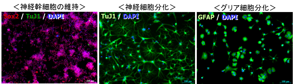 N2サプリメント[トランスフェリン(ホロ)含有]