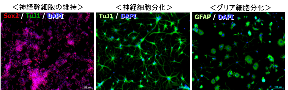 N2サプリメント[トランスフェリン(アポ)含有]