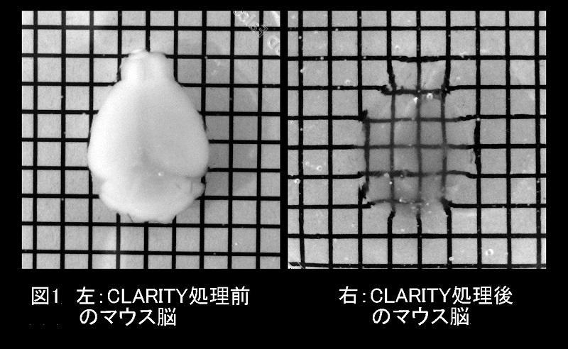 CLARITY処理によるマウス脳