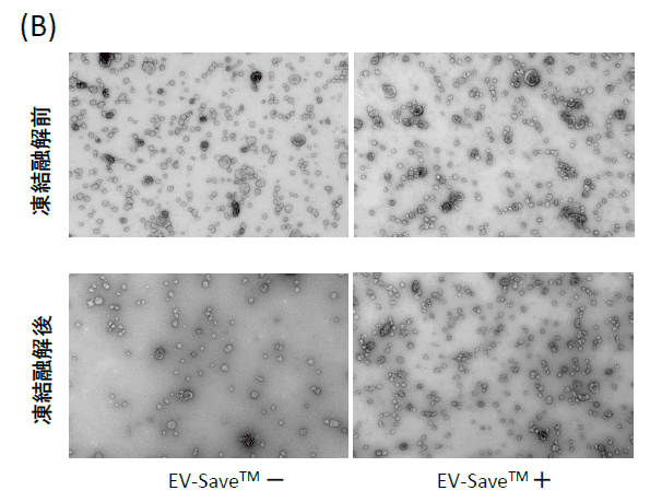 エクソソーム凍結保護効果の電子顕微鏡解析