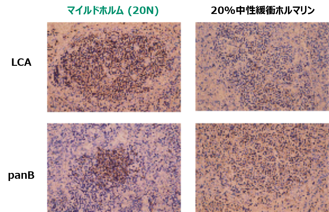 ヒトリンパ節組織の免疫組織染色