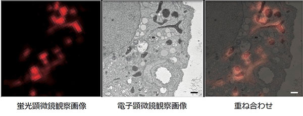 ミトコンドリアのCLEM法観察例