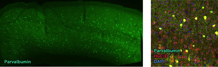 Immunohistochemistry
