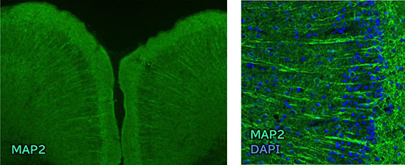 Immunohistochemistry