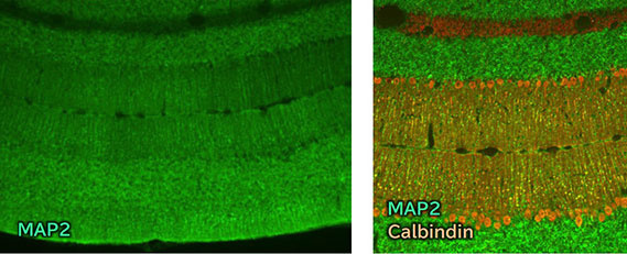 Immunohistochemistry