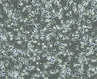 iCell® SensoryNeuronsの形態 (Day1)