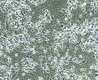 iCell® SensoryNeuronsの形態 (Day7)