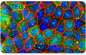 Alveolus Lung Chip