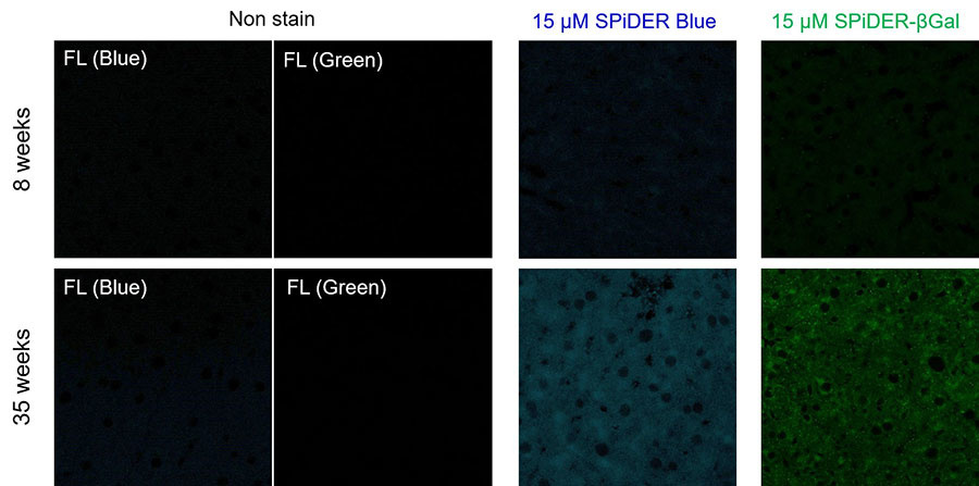 実験例：老化マウス肝臓脂肪組織切片の染色（SPiDER-βGalとの比較）