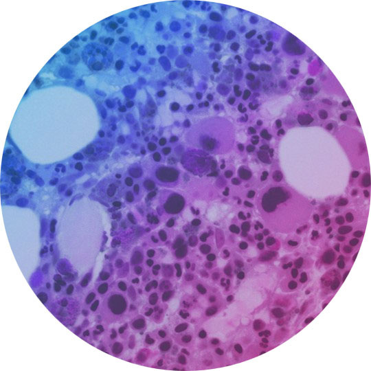 Bone Marrow-Chip