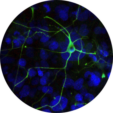 “Brain-Chip
