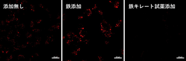 蛍光顕微鏡によるLyso-FerroRedのイメージング