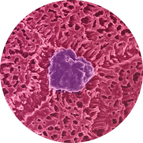 “Colon Intestine-Chip