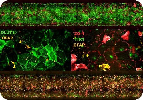 生理学的に関連した血液脳関門(BBB)