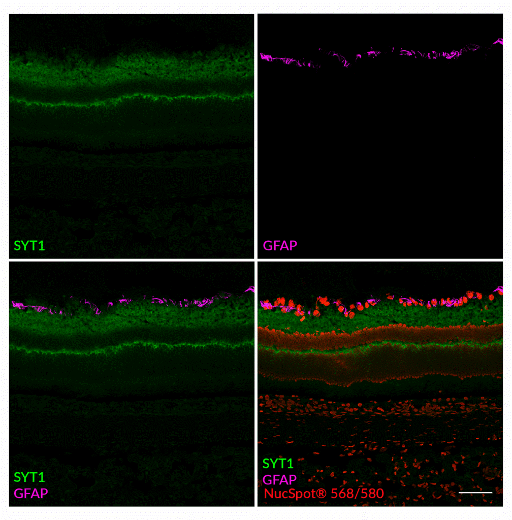 SYT1 Recombinant Alpaca VHHの染色結果