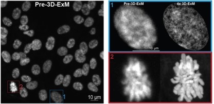 膨張による細胞の解像度の評価