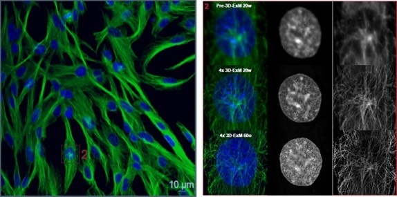 膨張後の核とチューブリンの観察