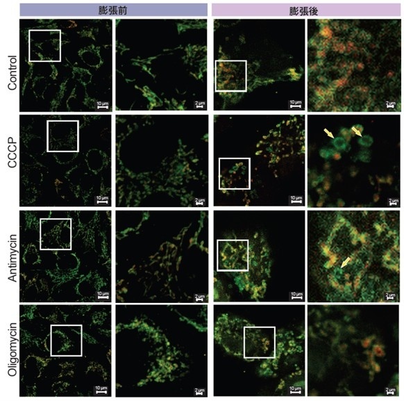 膨張後の核とチューブリンの観察