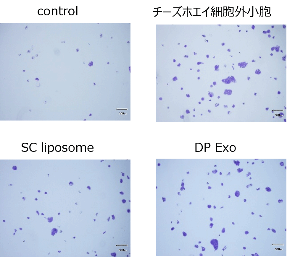 図1 HaCaT細胞培養後の顕微鏡画像