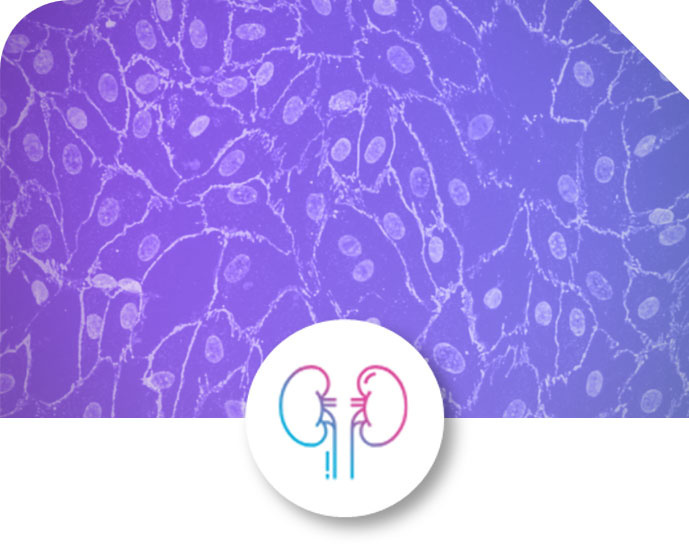 Kidney-Chip