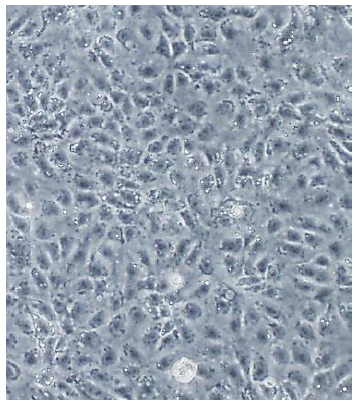 iCell 脳血管内皮細胞 の形態 (A)