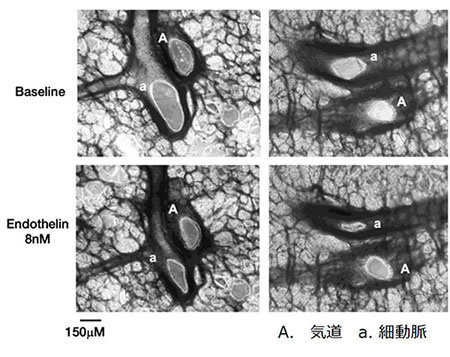 endothelin に対するPCLSの反応性