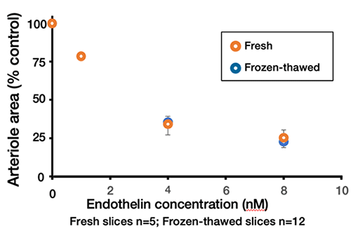 endothelin に対するPCLSの反応性