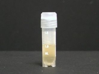 例:ヒト滑膜液