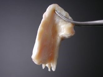 例:人間の膝蓋腱組織