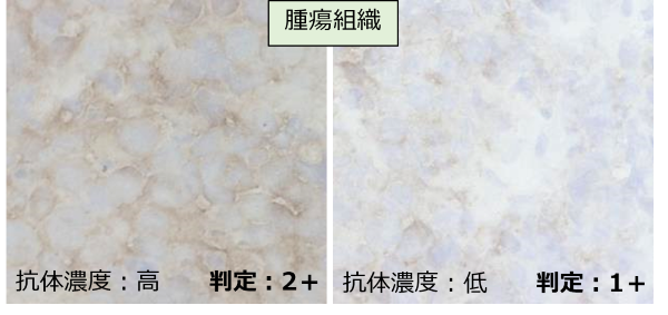 腫瘍組織