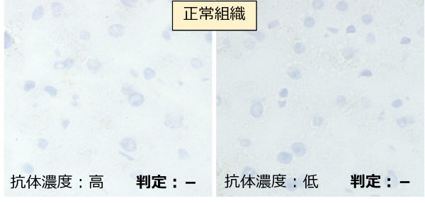 正常組織