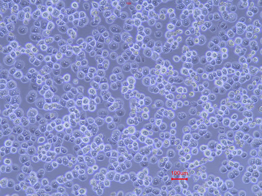 Magnification: 100X