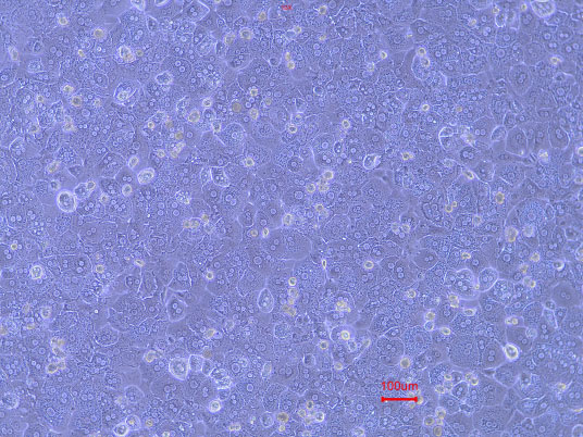 Magnification: 100X