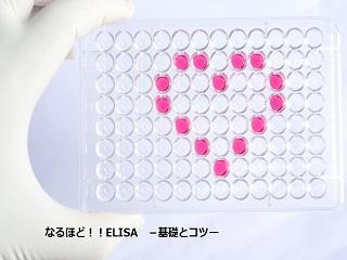 【連載】なるほど !!　ELISA　－基礎とコツ－　「第4回　ELISA の操作法とそのポイント（後編）」