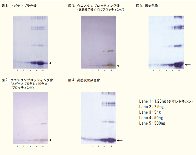 ネガティブ染色, ウエスタンブロッティング, 染色