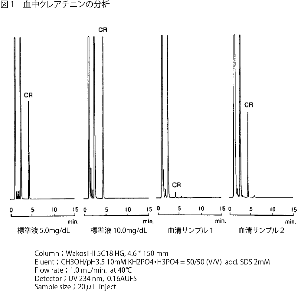 図1．血中クレアチニンの分析