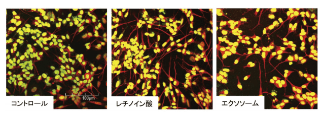 図3．カルノシン処理したCaco-2細胞培養上清由来エクソソームを添加したSH-SY5Y細胞における神経突起伸長