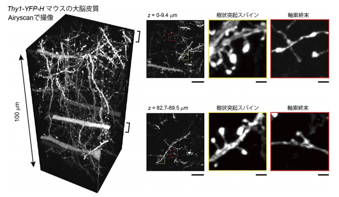 図4．Airyscan (Zeiss社)による脳スライスの観察例