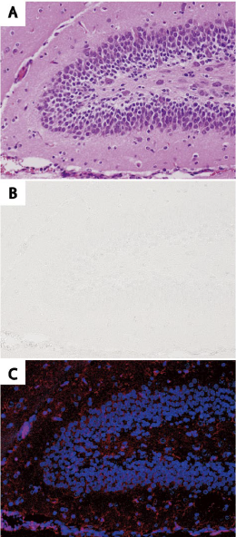 図１． deColorizing Solution 1 を用いたHE 染色後組織切片の脱色と再染色