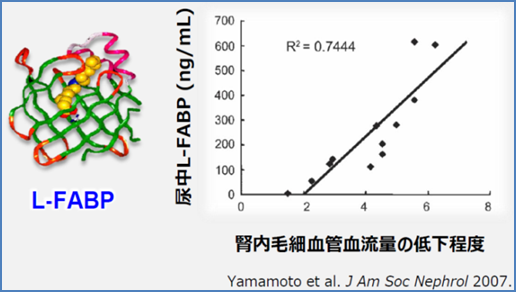 図1 ヒト尿細管周囲の血流と尿中L-FABPとの相関関係