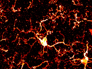 【連載】ミクログリア研究の最前線−基礎から臨床へ−　「第３回　脳内貪食細胞の謎に迫る」