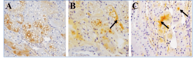 図1　ネコ腎臓の近位尿細管に分布するL-FABPが虚血再灌流により尿中に排泄される過程