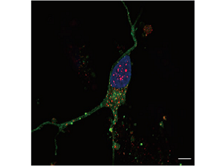 【総説】家族性パーキンソン病患者iPS細胞由来神経系細胞におけるエンドソーム機能障害