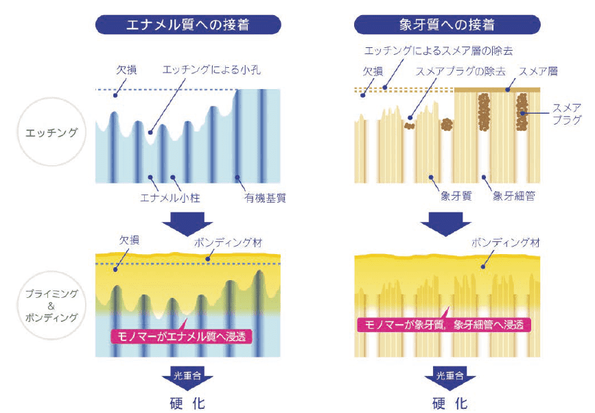 図３．歯質に対する接着機構