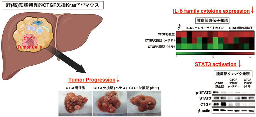 図１．肝癌細胞におけるCTGF の欠損による肝癌増大進展抑制