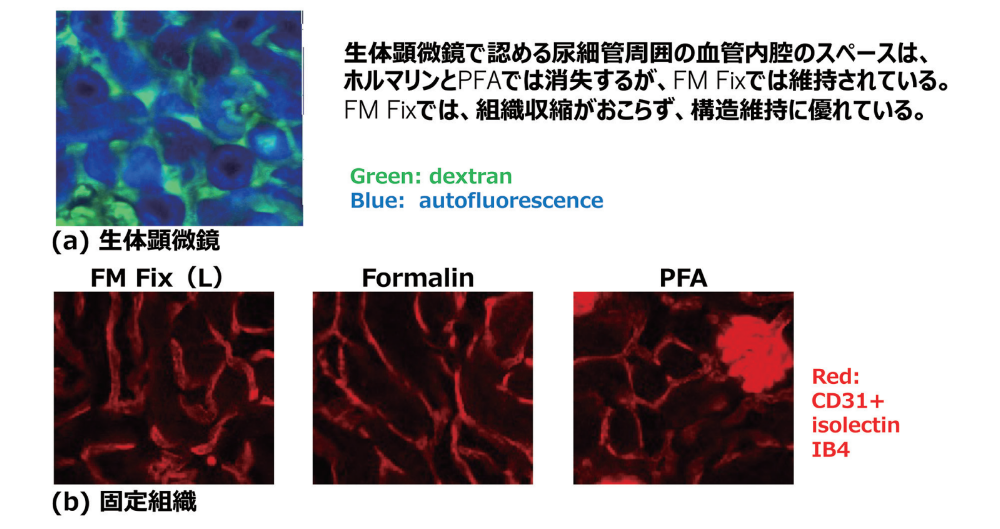 図1.FM Fixの構造保持性